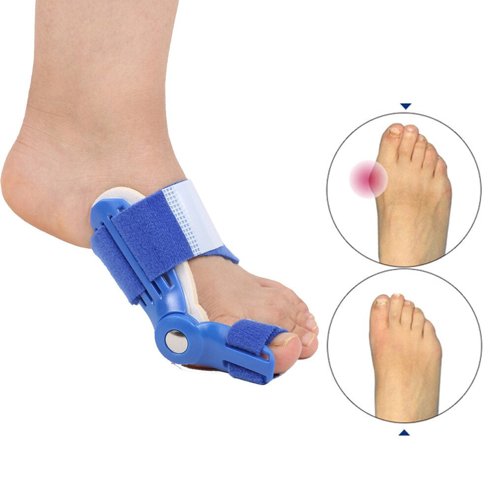 Blauer Hallux-Valgus-Korrektor für Fuß, Schiene zur Zehenkorrektur, orthopädische Unterstützung.