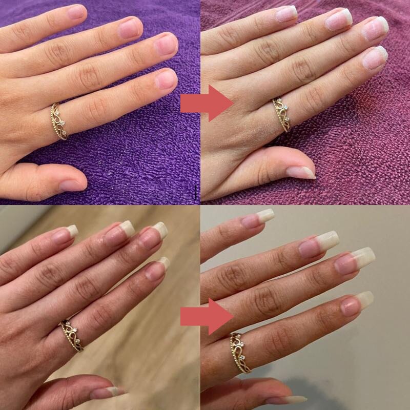 Före och efter-bilder av två händer med ring som visar naglarna innan och efter behandlingen 9