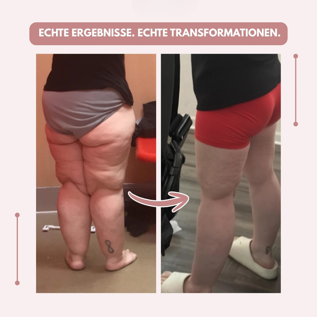 Före- och efterbild av en kvinnas ben bakifrån, med bildtext om verkliga resultat och transformationer. 10