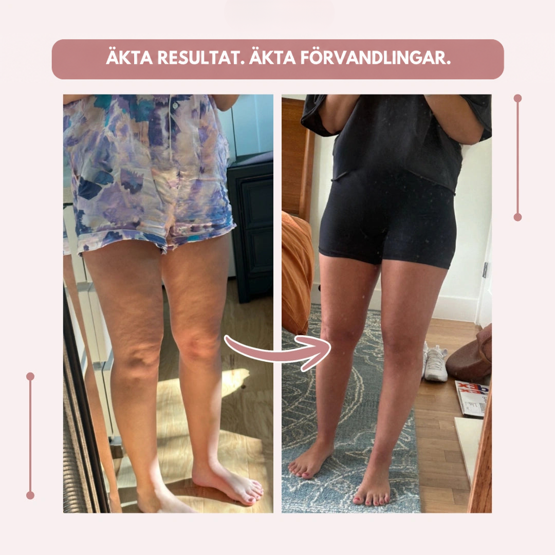Före- och efterbild tagna framför spegel av en kvinnas ben i shorts, med bildtext om verkliga resultat och transformationer. 19