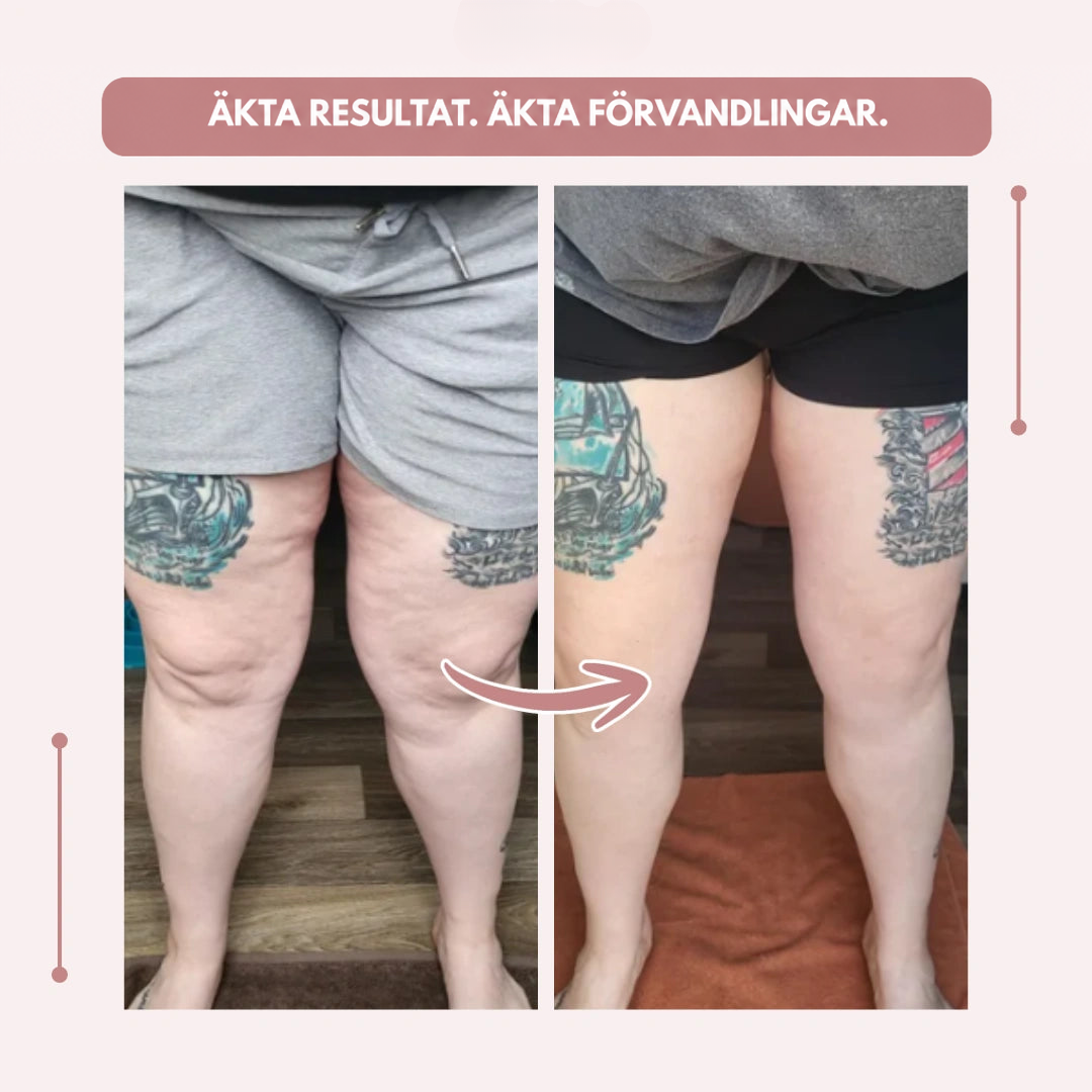 Före- och efterbild av tatuerade lår framifrån, med bildtext om verkliga resultat och transformationer. 18