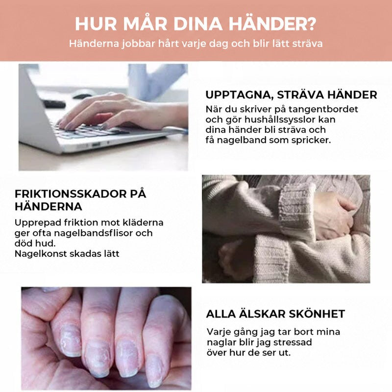 Tre vardagsscener med händer som skriver på laptop, gnuggas mot tröjärm och naglar med sprickor 6
