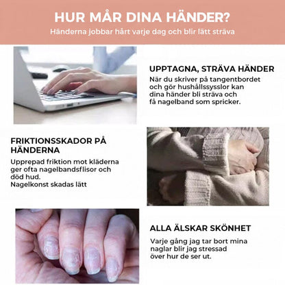 Tre vardagsscener med händer som skriver på laptop, gnuggas mot tröjärm och naglar med sprickor 6
