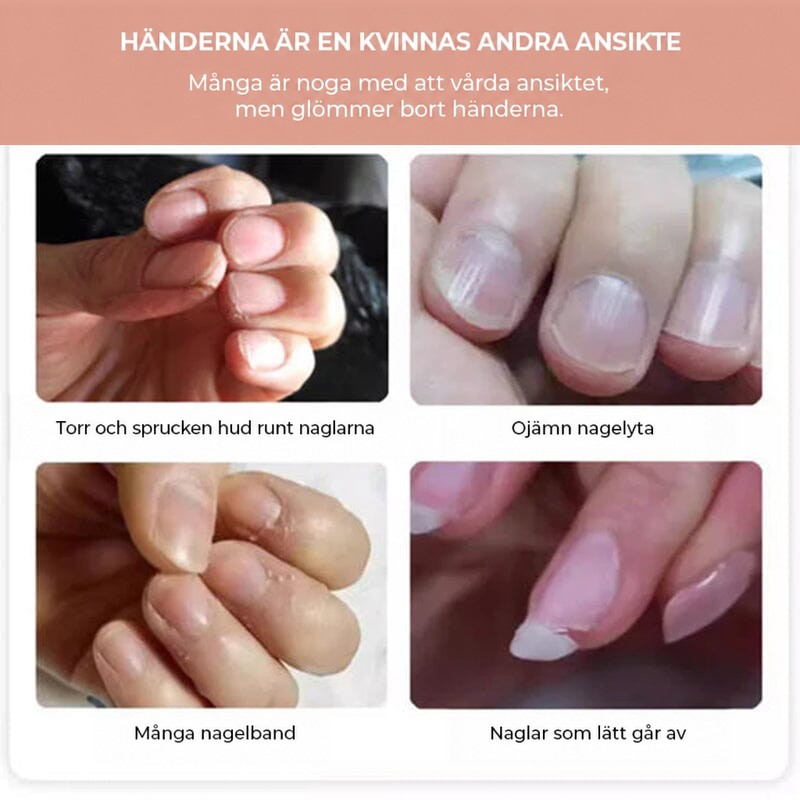 Fyra närbilder av torra nagelband, ojämna naglar, nagelbandsrester och naglar som går av, med tyska bildtexter 3