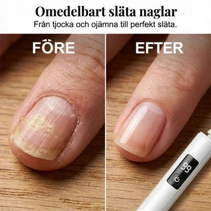 Före och efter: en ojämn, gulaktig nagel jämfört med en slät, jämn nagel, med nagelfilen nere i hörnet 4