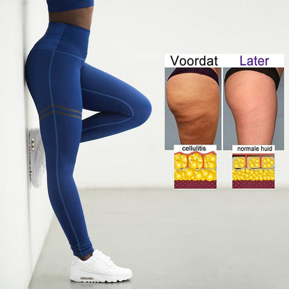 Frau in blauer Sportleggings, zeigt Vorher-Nachher-Ergebnis bei Cellulite, Fitness, Gesundheit.