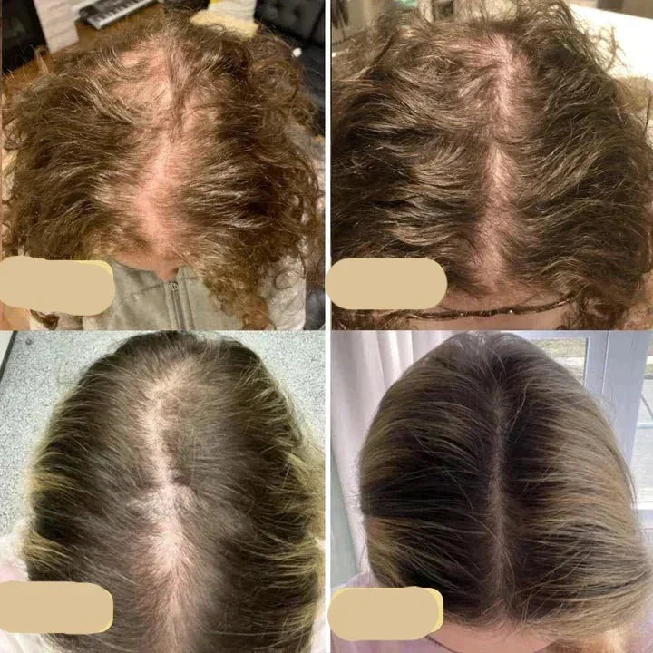 Vorher-Nachher-Bilder Haarwachstum, vegane Haaröl-Behandlung, Bayuna, Haarausfall, Ergebnisse