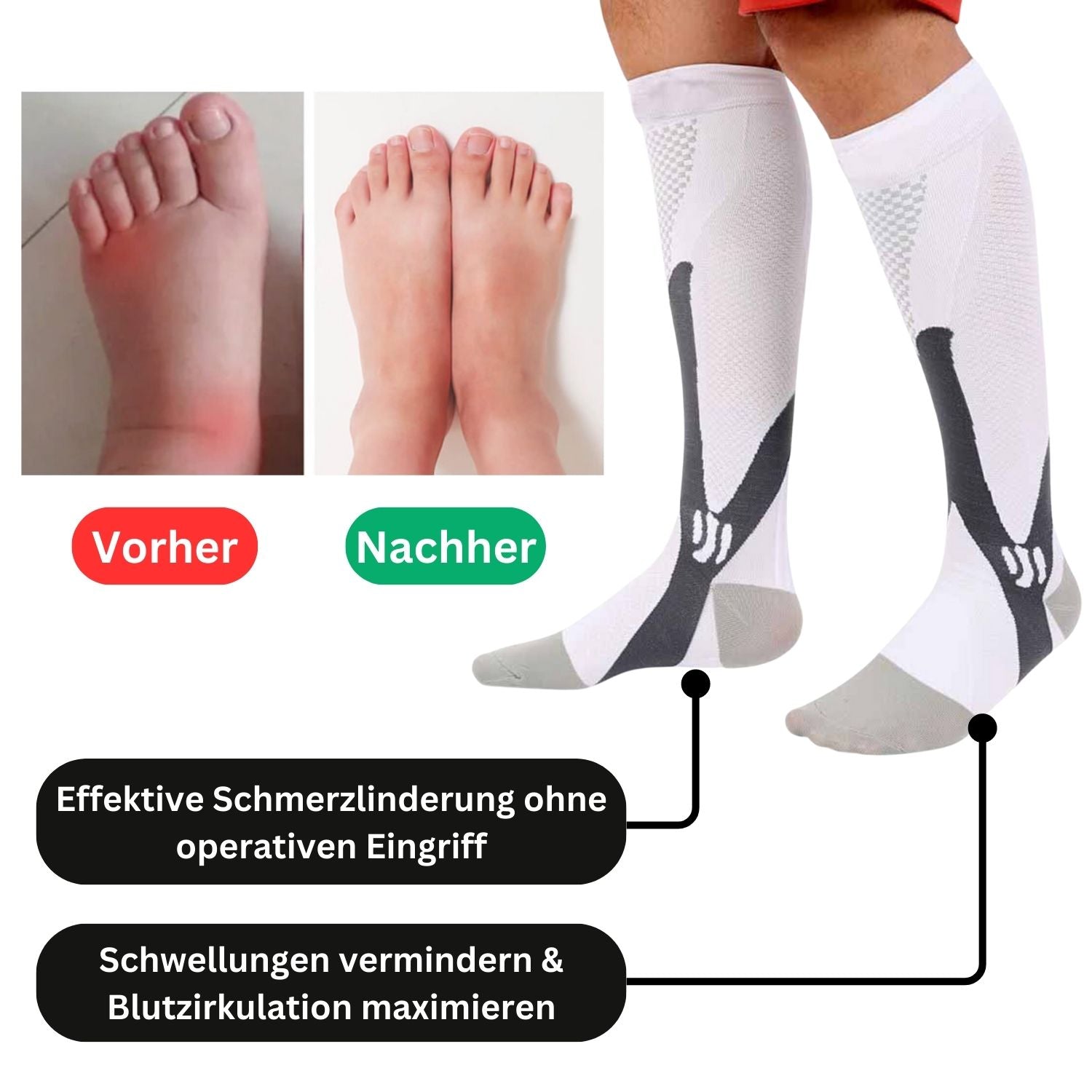 Weiße Kompressionsstrümpfe zur Schmerzlinderung und Verbesserung der Blutzirkulation.